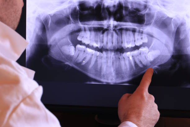 Best Emergency Root Canal Treatment in Barbourville, KY